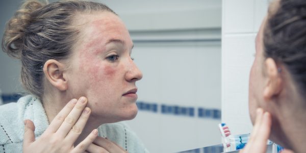 Is Toner Supposed To Burn Or Sting Your Skin?