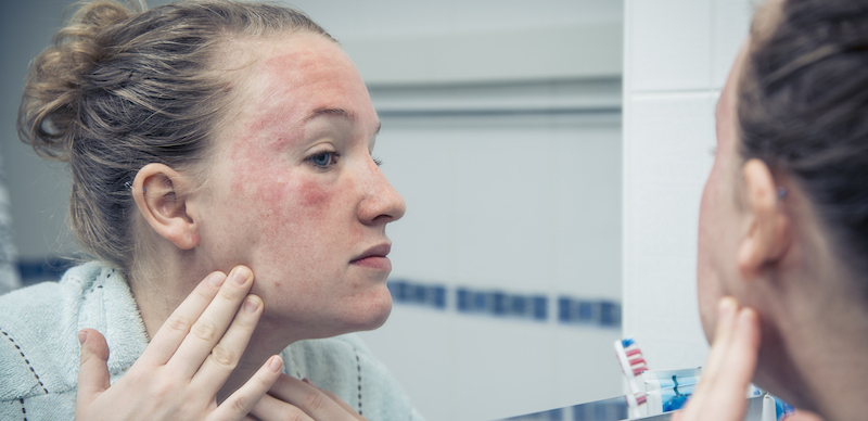 Is Toner Supposed To Burn Or Sting Your Skin?