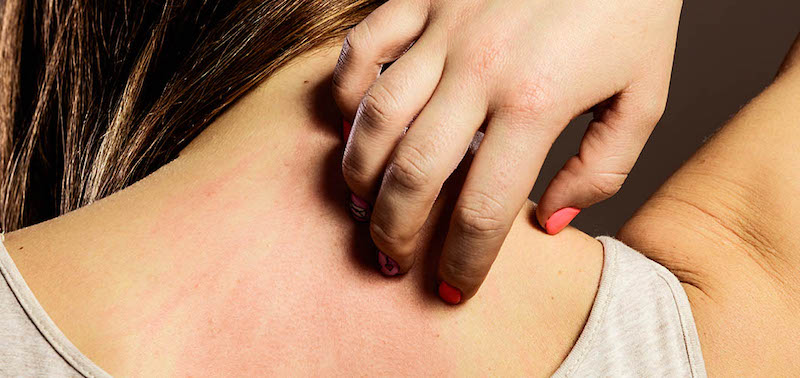 Why Does Lotion Burn? - 6 Possible Reasons & What To Do