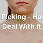 Skin Picking - How To Deal With It (My Story)